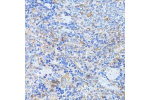 Immunohistochemistry of paraffin-embedded rat spleen using ARRB1 antibody. (beta Arrestin 1 抗体  (AA 169-418))