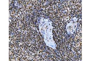 IHC analysis of UBC12/UBE2M using anti-UBC12/UBE2M antibody (ABIN7600885). (UBE2M 抗体  (AA 25-154))