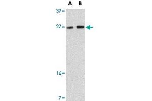 Western blot analysis of TMEM18 in rat brain tissue lysate with TMEM18 polyclonal antibody  at (A) 0. (Transmembrane Protein 18 (TMM18) (C-Term) 抗体)