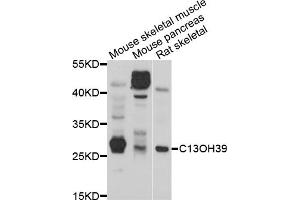 Western blot analysis of extracts of various cell lines, using METTL21C antibody (ABIN5998216) at 1/1000 dilution. (METTL21C 抗体)