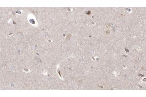 Immunohistochemistry (IHC) image for anti-Cytochrome P450, Family 26, Subfamily B, Polypeptide 1 (CYP26B1) (Internal Region) antibody (ABIN6261169)