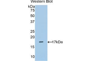 Western blot analysis of the recombinant protein. (SLC3A2 抗体  (AA 270-406))
