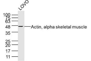 Image no. 2 for anti-Actin, alpha 1, Skeletal Muscle (ACTA1) antibody (ABIN5675170)
