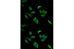 Immunofluorescence (IF) image for anti-Lymphocyte Cytosolic Protein 1 (LCP1) antibody (ABIN1876741) (LCP1 抗体)