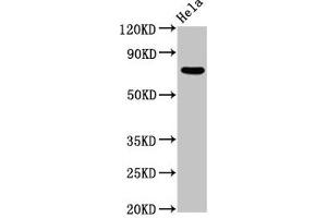 Western Blot Positive WB detected in: Hela whole cell lysate All lanes: MTMR2 antibody at 5. (MTMR2 抗体  (AA 1-173))