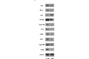 Over-expression of sGC induced apoptosis and cell cycle arrest. (CDC25A 抗体  (N-Term))