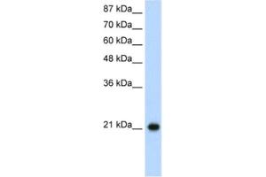 Western Blotting (WB) image for anti-Ribosomal Protein L9 (RPL9) antibody (ABIN2462051) (RPL9 抗体)