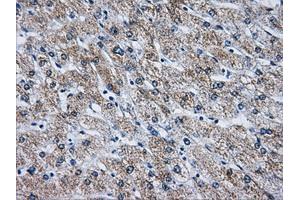 Immunohistochemical staining of paraffin-embedded liver tissue using anti-ATP5B mouse monoclonal antibody. (ATP5B 抗体)