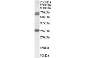 Image no. 2 for anti-Glutamate Decarboxylase 2 (Pancreatic Islets and Brain, 65kDa) (GAD2) (Internal Region) antibody (ABIN185388)