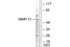 Western Blotting (WB) image for anti-Matrix Metallopeptidase 11 (Stromelysin 3) (MMP11) (Internal Region) antibody (ABIN1848672) (MMP11 抗体  (Internal Region))