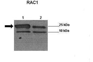 Sample Type: Lane 1:241 µg siRUVBL1 transfected human H1299 cells Lane 2: 041 µg untransfected human H1299 cells Primary Antibody Dilution: 1:0000Secondary Antibody: Anti-rabbit-HRP Secondary Antibody Dilution: 1:0000 Color/Signal Descriptions: RAC1  Gene Name: Wenwei Hu, Xuetian Yue, Rutgers Cancer Institute of New Jersey. (RAC1 抗体  (Middle Region))
