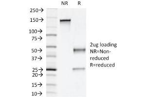 SDS-PAGE Analysis Purified Napsin A Mouse Monoclonal Antibody (NAPSA/1239).