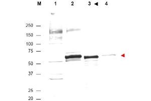 Image no. 1 for anti-V-Akt Murine Thymoma Viral Oncogene Homolog 1 (AKT1) (Internal Region) antibody (ABIN401484)