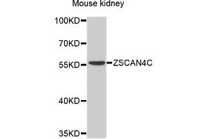 Western blot analysis of extracts of mouse kidney, using ZSCAN4 antibody. (ZSCAN4 抗体)