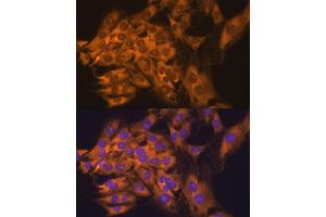 Immunofluorescence (IF) image for anti-Ribosomal Protein L17 (RPL17) (AA 1-184) antibody (ABIN6147115)