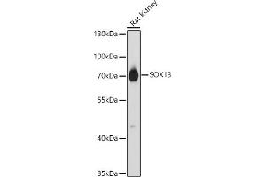 Western blot analysis of extracts of Rat kidney, using SOX13 antibody (ABIN7270570) at 1:1000 dilution. (SOX13 抗体  (AA 1-180))