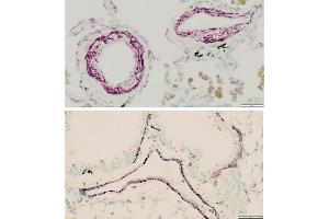 Immunohistochemistry (IHC) image for anti-Actin, alpha 2, Smooth Muscle, Aorta (ACTA2) (N-Term) antibody (ABIN185271)