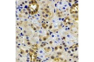Immunohistochemical analysis of ADH4 staining in rat kidney formalin fixed paraffin embedded tissue section. (ADH4 抗体)
