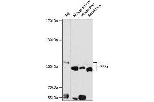 Western blot analysis of extracts of various cell lines, using PKP2 antibody (ABIN1876693) at 1:1000 dilution. (Plakophilin 2 抗体)