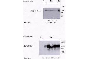 Image no. 1 for anti-EPH Receptor B1 (EPHB1) antibody (ABIN264959) (EPH Receptor B1 抗体)