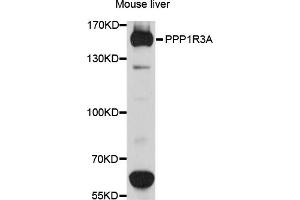 Western blot analysis of extracts of mouse liver, using PPP1R3A antibody (ABIN6003865) at 1/1000 dilution. (PPP1R3A 抗体)
