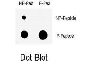 Dot blot analysis of CHEK1 (phospho S317) polyclonal antibody  on nitrocellulose membrane.