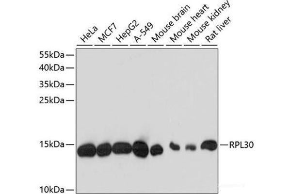 RPL30 Antikörper