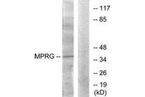 Western Blotting (WB) image for anti-Progestin and AdipoQ Receptor Family Member V (PAQR5) (AA 281-330) antibody (ABIN2890895) (PAQR5 抗体  (AA 281-330))