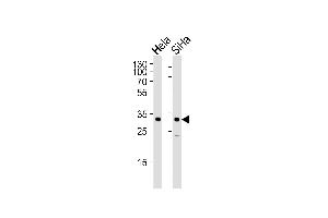 Western blot analysis of lysates from Hela, SiHa cell line (from left to right), using SNAI1 Antibody (N-term R8) (ABIN388812 and ABIN2839130). (SNAIL 抗体  (N-Term))
