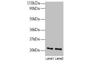 Western blot All lanes: ARF4 antibody at 2 μg/mL Lane 1: EC109 whole cell lysate Lane 2: 293T whole cell lysate Secondary Goat polyclonal to rabbit IgG at 1/15000 dilution Predicted band size: 21 kDa Observed band size: 21 kDa