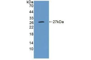 Detection of Recombinant GluAP, Human using Polyclonal Antibody to Aminopeptidase A (ENPEP) (ENPEP 抗体  (AA 718-948))