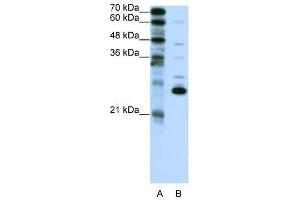 RCV1 antibody used at 2. (Recoverin 抗体  (C-Term))