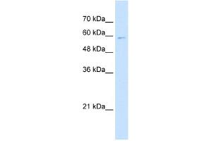 WB Suggested Anti-IRF4 Antibody Titration:  5. (IRF4 抗体  (N-Term))