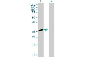 Western Blot analysis of EVI2A expression in transfected 293T cell line by EVI2A MaxPab polyclonal antibody. (EVI2A 抗体  (AA 25-236))