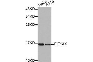 Western Blotting (WB) image for anti-Eukaryotic Translation Initiation Factor 1A, X-Linked (EIF1AX) antibody (ABIN1876946) (EIF1AX 抗体)