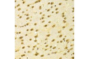 Immunohistochemistry of paraffin-embedded rat brain using HDGF Antibody. (HDGF 抗体  (AA 1-240))