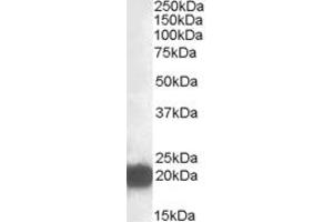 Western Blotting (WB) image for anti-Cysteine and Glycine-Rich Protein 3 (CSRP3) (Internal Region) antibody (ABIN2466624) (CSRP3 抗体  (Internal Region))