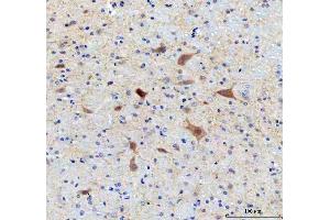 IHC analysis of SAMSN1 using anti-SAMSN1 antibody (ABIN7602721).