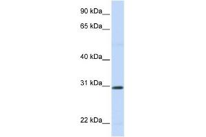 STC1 antibody used at 1 ug/ml to detect target protein. (Stanniocalcin 1 抗体  (N-Term))