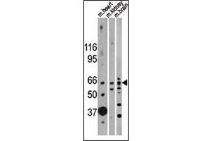 Western blot analysis of anti-ACVR2B Antibody (N-term) in mouse heart, kidney and brain lysates (35ug/lane).