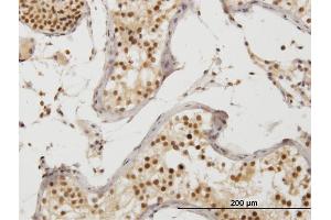 Immunoperoxidase of monoclonal antibody to ZAK on formalin-fixed paraffin-embedded human prostate. (ZAK 抗体  (AA 1-120))