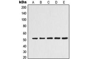 Western blot analysis of Alpha-tubulin 3C/D/E expression in K562 (A), Jurkat (B), HeLa (C), HepG2 (D), NIH3T3 (E) whole cell lysates. (alpha-Tubulin 3C/D/E (C-Term) 抗体)