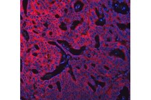 IF analysis of SWAP70 using anti-SWAP70 antibody (ABIN7600201). (SWAP70 抗体  (AA 161-292))