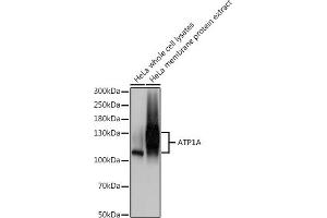 Western blot analysis of extracts of HeLa cells, using A antibody (ABIN1512611, ABIN3021021, ABIN3021022, ABIN1513797 and ABIN6213916) at 1:500 dilution. (ATP1A (AA 551-850) 抗体)