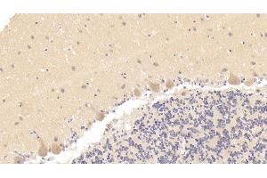 #VALUE! (Caspase 7 抗体  (AA 24-198))