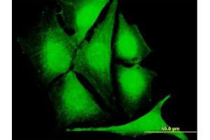 Immunofluorescence of purified MaxPab antibody to CLK1 on HeLa cell. (CLK1 抗体  (AA 1-484))