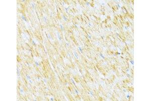 Immunohistochemistry of paraffin-embedded Rat heart using UQCR10 Polyclonal Antibody at dilution of 1:100 (40x lens). (UQCR10 抗体)
