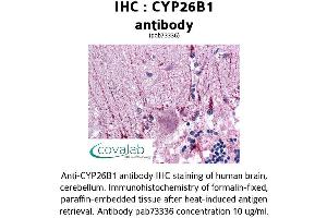 Image no. 2 for anti-Cytochrome P450, Family 26, Subfamily B, Polypeptide 1 (CYP26B1) (AA 160-396) antibody (ABIN1733454) (CYP26B1 抗体  (AA 160-396))