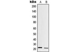 Western blot analysis of Trypsin 1 expression in HT1080 (A), human pancreas (B) whole cell lysates. (PRSS1 抗体  (Center))