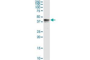 PIPOX MaxPab rabbit polyclonal antibody. (PIPOX 抗体  (AA 1-390))